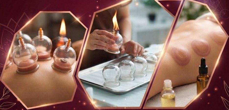 Glass cupping vessels warmed by flame, set out on a tray and applied along a patient's back
